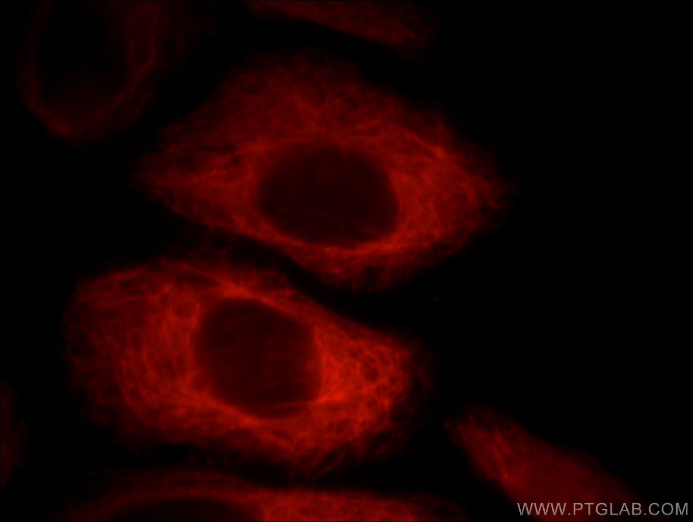 Immunofluorescence (IF) / fluorescent staining of HepG2 cells using Villin Monoclonal antibody (66096-1-Ig)