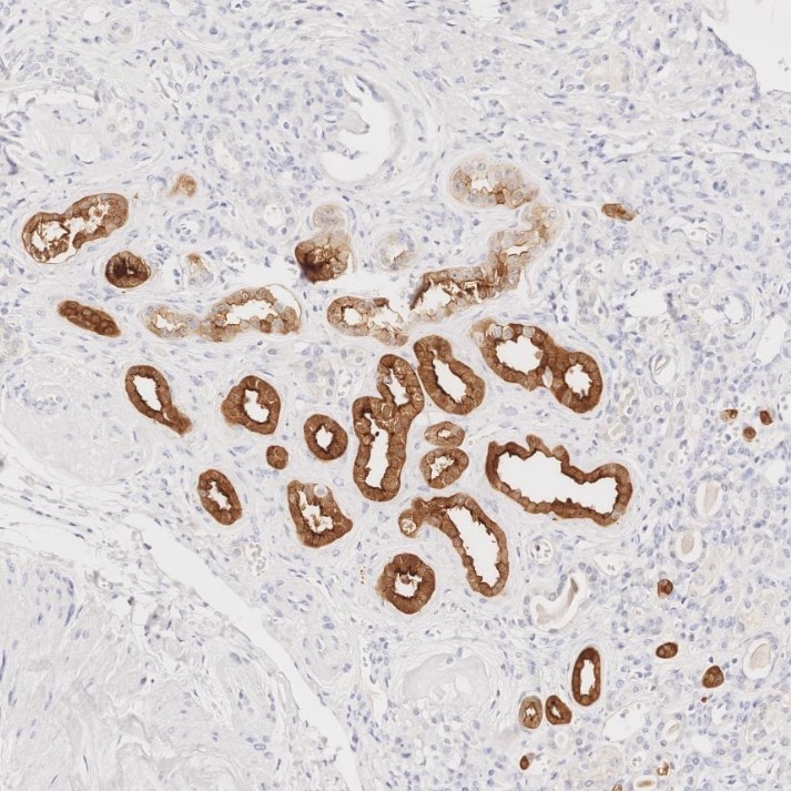 IHC staining of human kidney using 66096-1-Ig Immunohistochemistry (IHC) staining of human kidney tissue using Villin Monoclonal antibody (66096-1-Ig)