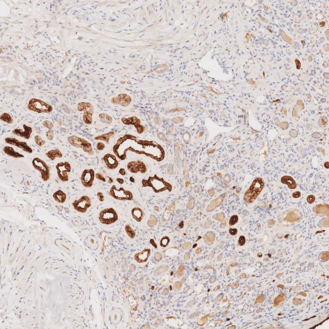 IHC staining of human kidney using 66096-1-Ig Immunohistochemistry (IHC) staining of human kidney tissue using Villin Monoclonal antibody (66096-1-Ig)