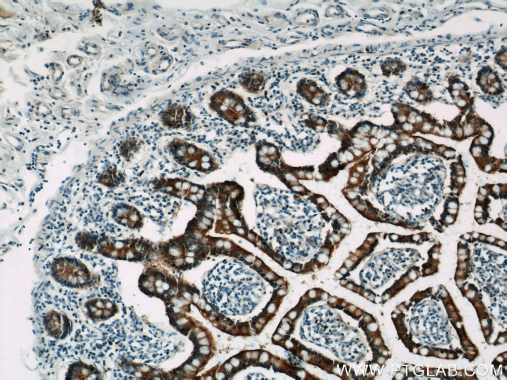 Immunohistochemistry (IHC) staining of human small intestine tissue using Villin Monoclonal antibody (66096-1-Ig)