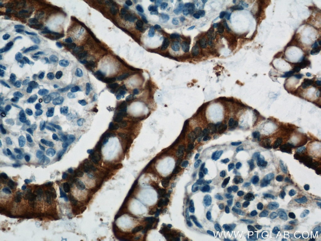 Immunohistochemistry (IHC) staining of human small intestine tissue using Villin Monoclonal antibody (66096-1-Ig)