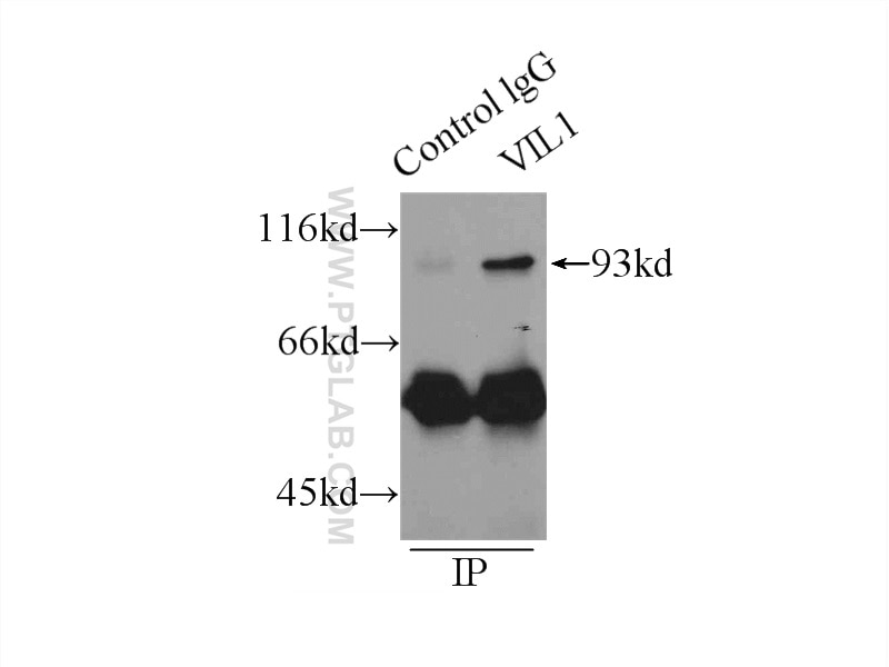 Immunoprecipitation (IP) experiment of mouse kidney tissue using Villin Monoclonal antibody (66096-1-Ig)