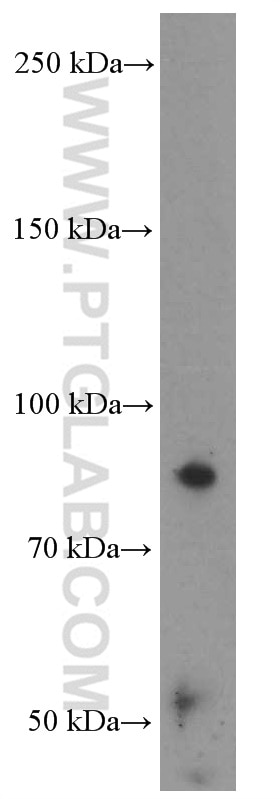 Western Blot (WB) analysis of human colon tissue using Villin Monoclonal antibody (66096-1-Ig)