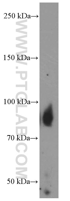 Western Blot (WB) analysis of human small intestine tissue using Villin Monoclonal antibody (66096-1-Ig)