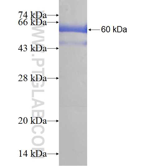 VIL1 fusion protein Ag9610 SDS-PAGE