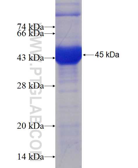 VIL1 fusion protein Ag9637 SDS-PAGE