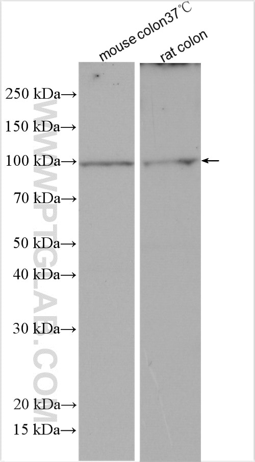 Western Blot (WB) analysis of various lysates using Villin like Polyclonal antibody (15130-1-AP)