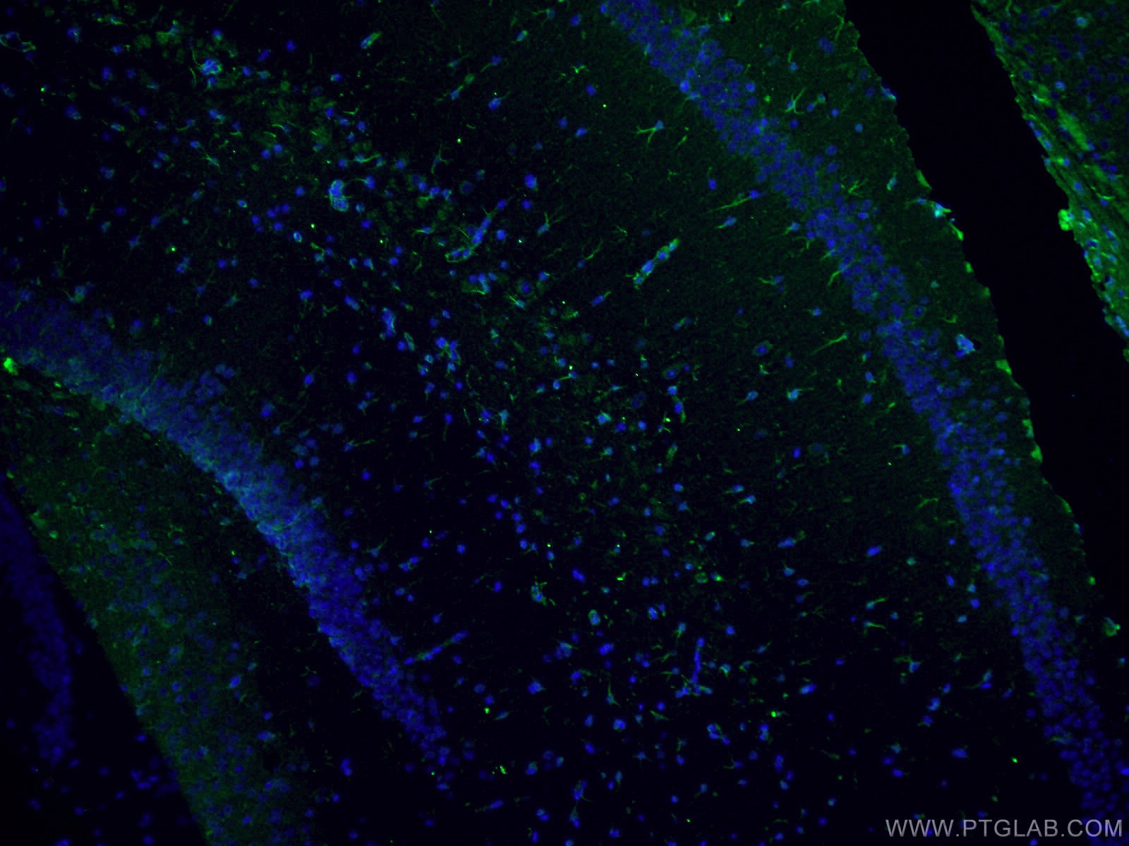 Immunofluorescence (IF) / fluorescent staining of mouse brain tissue using Vimentin Polyclonal antibody (10366-1-AP)