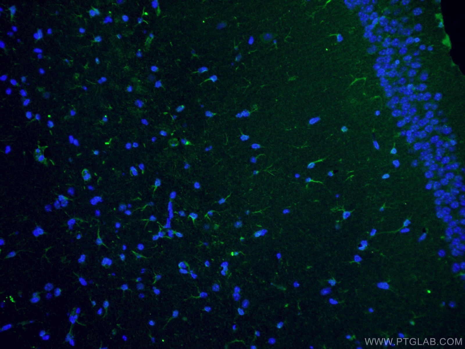 Immunofluorescence (IF) / fluorescent staining of mouse brain tissue using Vimentin Polyclonal antibody (10366-1-AP)
