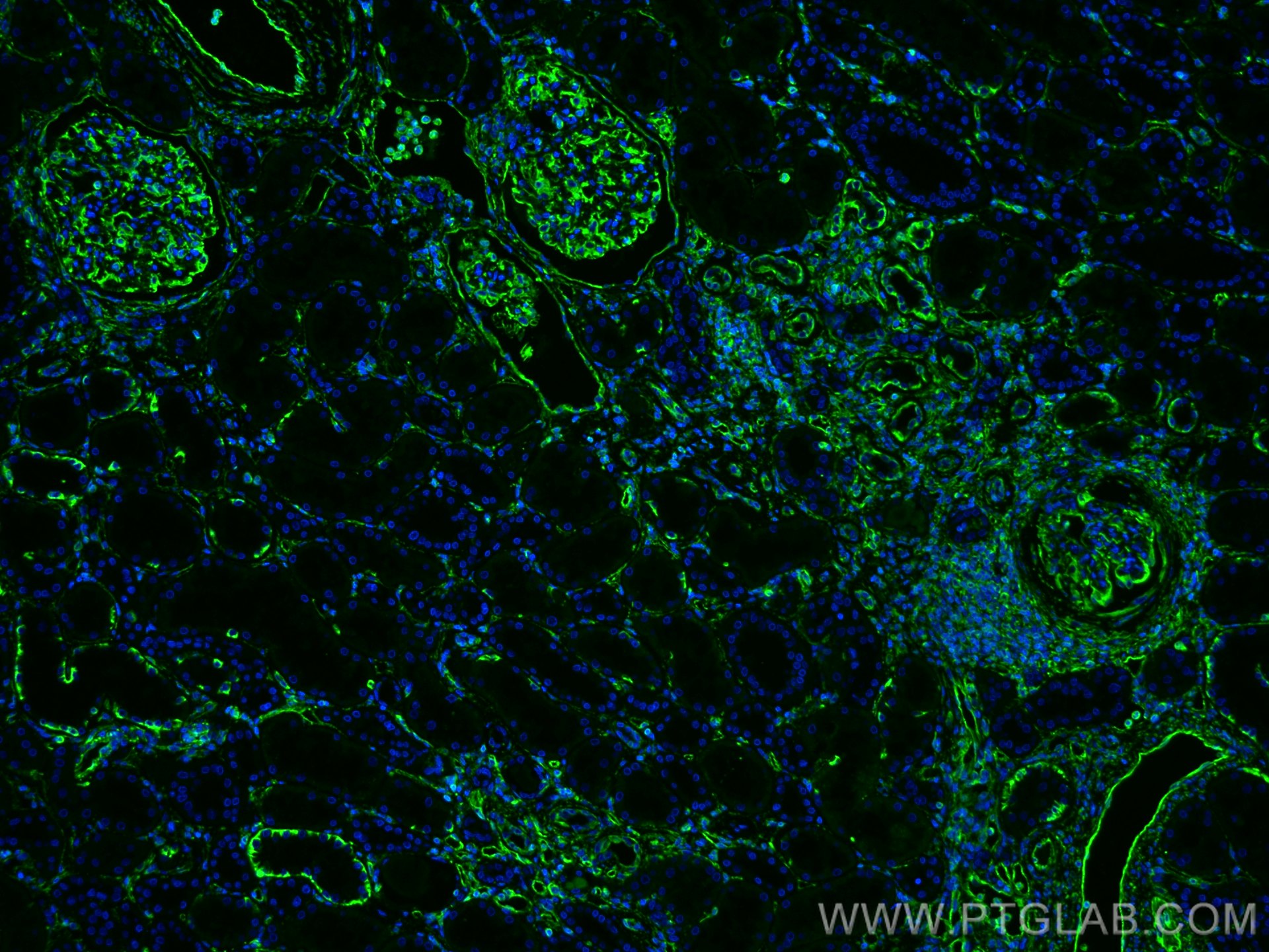 IF Staining of human kidney using 10366-1-AP