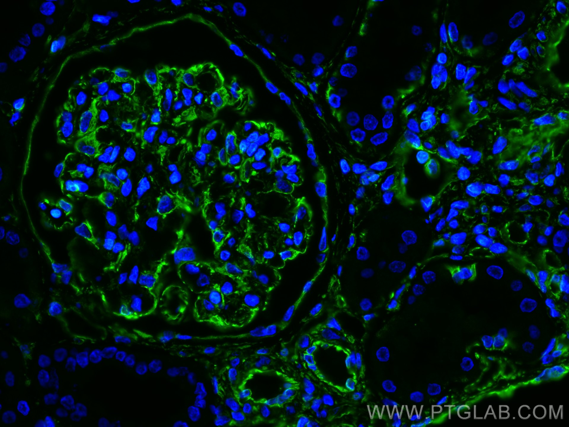 Immunofluorescence (IF) / fluorescent staining of human kidney tissue using Vimentin Polyclonal antibody (10366-1-AP)