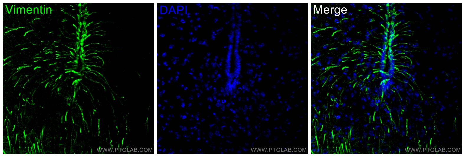 Immunofluorescence (IF) / fluorescent staining of mouse brain tissue using Vimentin Polyclonal antibody (10366-1-AP)
