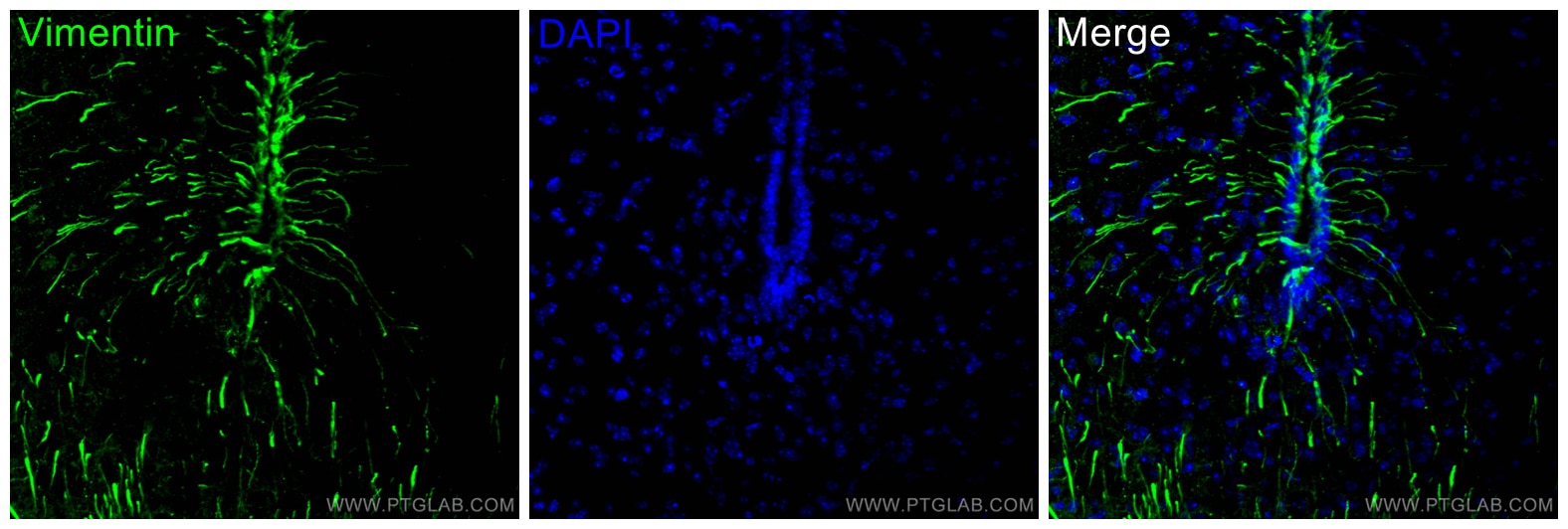 IF Staining of mouse brain using 10366-1-AP