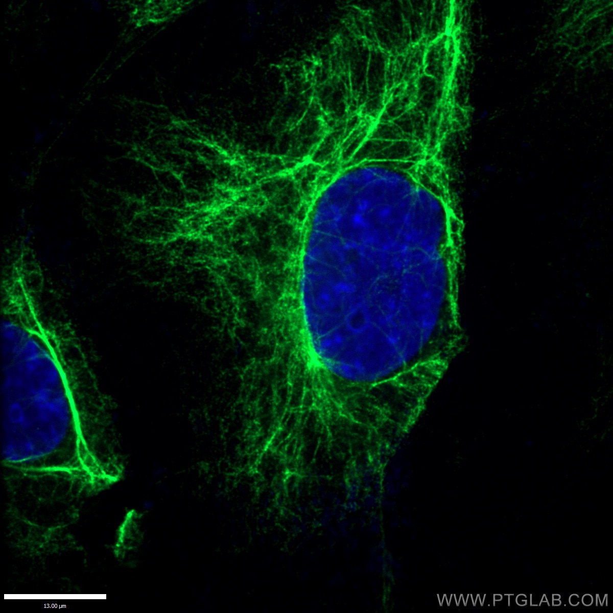 Immunofluorescence (IF) / fluorescent staining of HepG2 cells using Vimentin Polyclonal antibody (10366-1-AP)