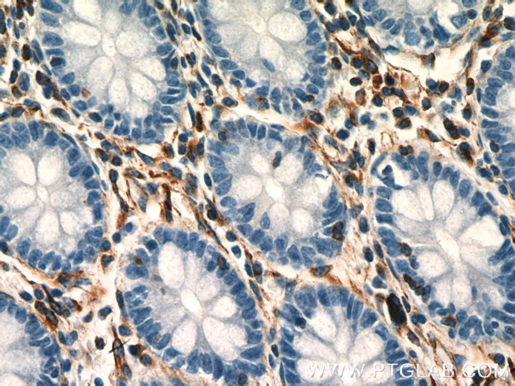 Vimentin