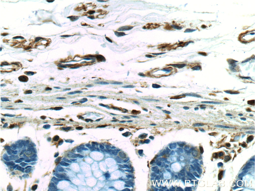 Vimentin Polyclonal antibody