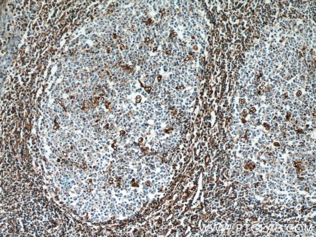 Vimentin Polyclonal antibody