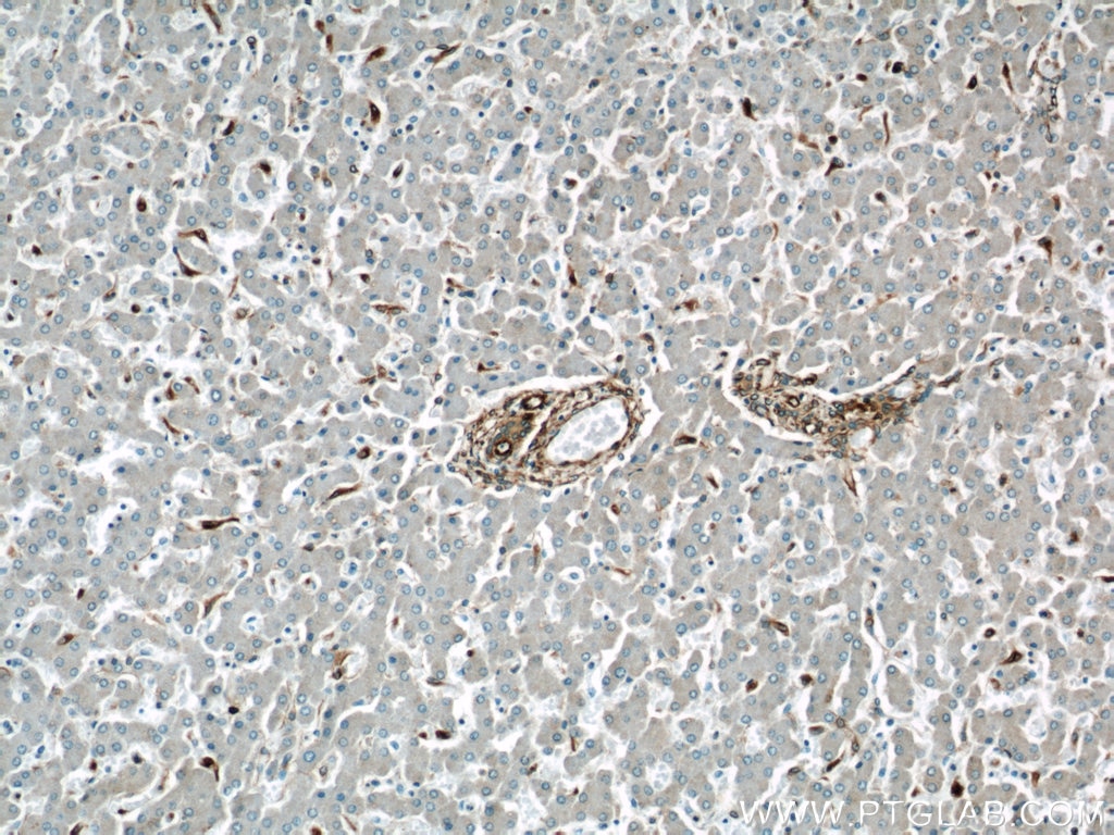 IHC staining of human liver using 10366-1-AP