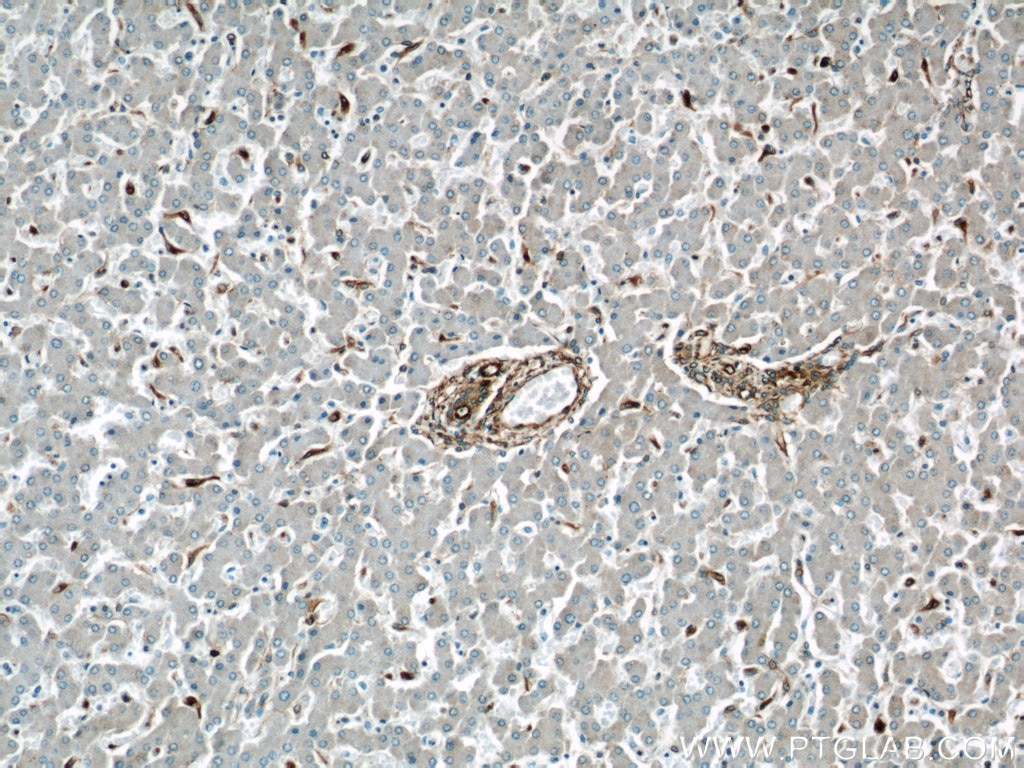 Immunohistochemistry (IHC) staining of human liver tissue using Vimentin Polyclonal antibody (10366-1-AP)