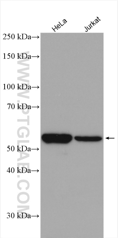 Western Blot (WB) analysis of various lysates using Vimentin Polyclonal antibody (10366-1-AP)