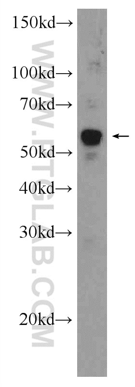 Western Blot (WB) analysis of mouse heart tissue using Vimentin Polyclonal antibody (10366-1-AP)