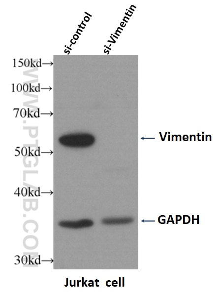 Western Blot (WB) analysis of Jurkat cells using Vimentin Polyclonal antibody (10366-1-AP)