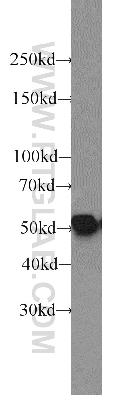 Vimentin Polyclonal antibody