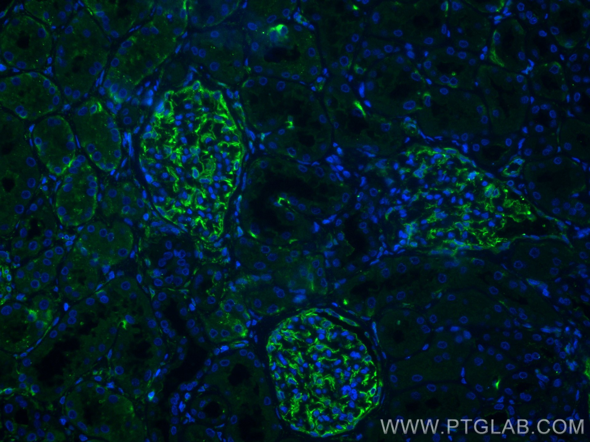 Immunofluorescence (IF) / fluorescent staining of human kidney tissue using Vimentin Polyclonal antibody (22031-1-AP)