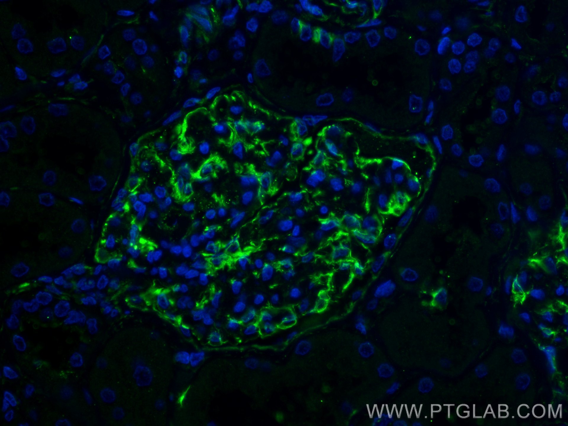 Immunofluorescence (IF) / fluorescent staining of human kidney tissue using Vimentin Polyclonal antibody (22031-1-AP)