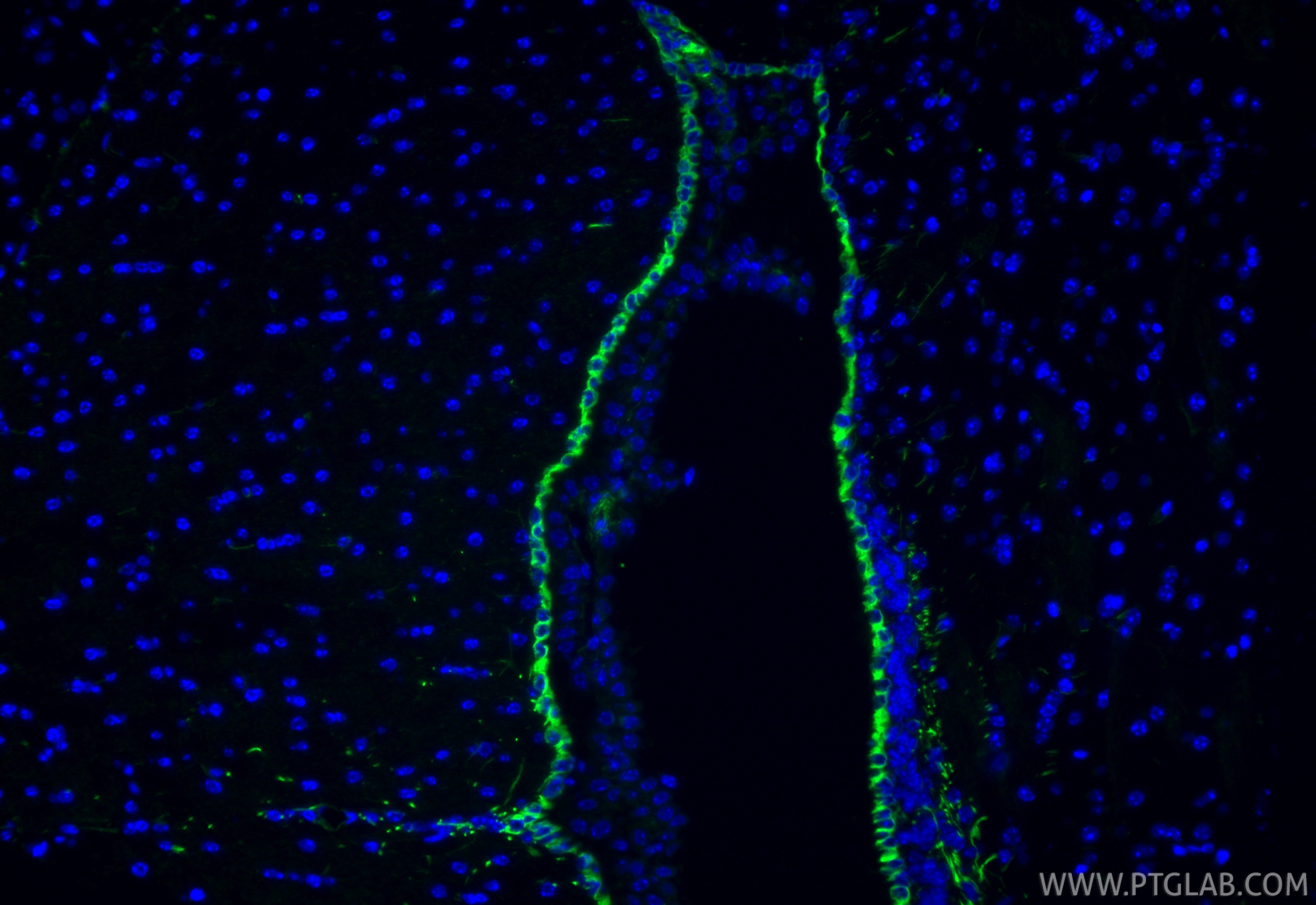 Immunofluorescence (IF) / fluorescent staining of mouse brain tissue using Vimentin Polyclonal antibody (22031-1-AP)