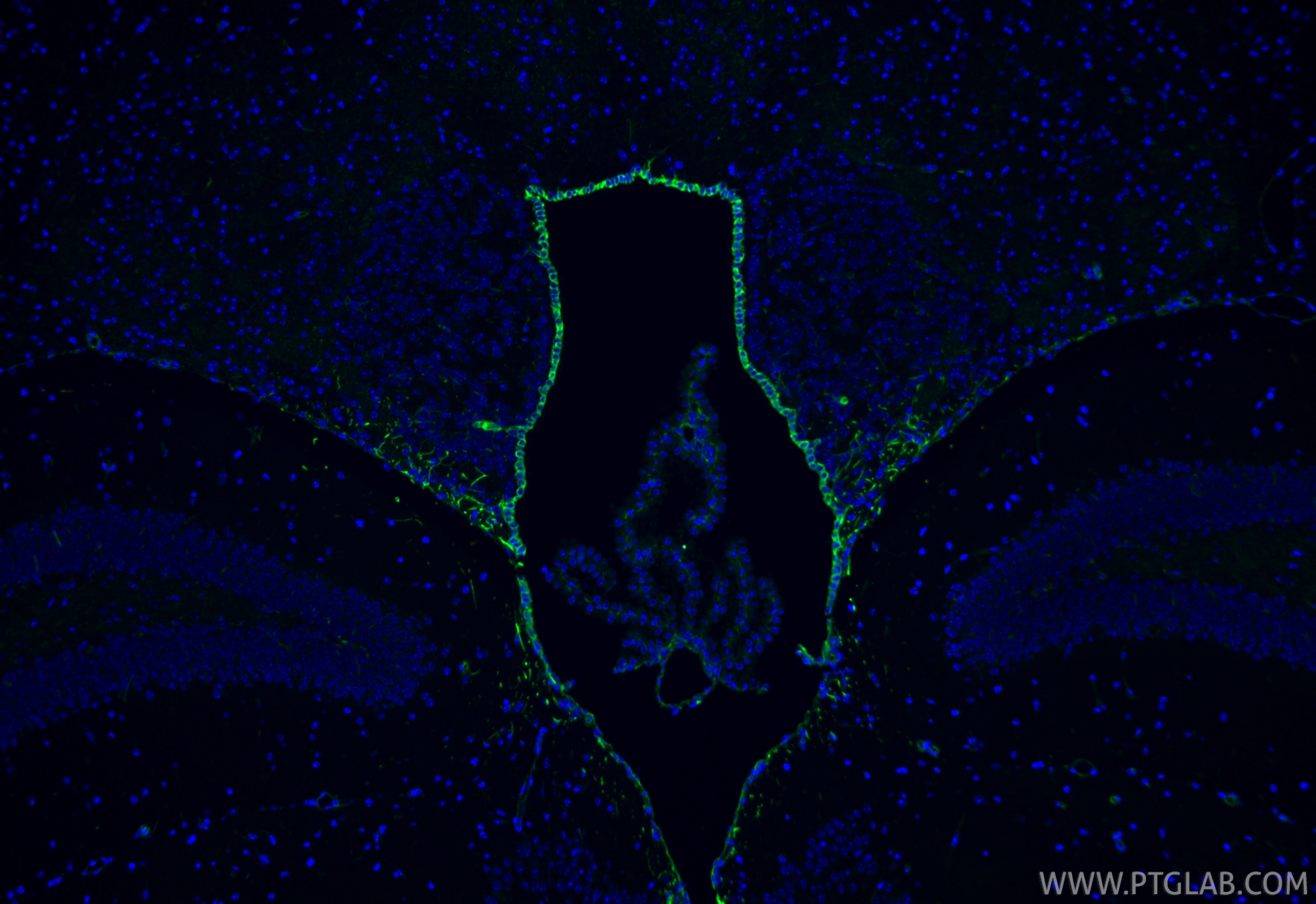 Immunofluorescence (IF) / fluorescent staining of mouse brain tissue using Vimentin Polyclonal antibody (22031-1-AP)