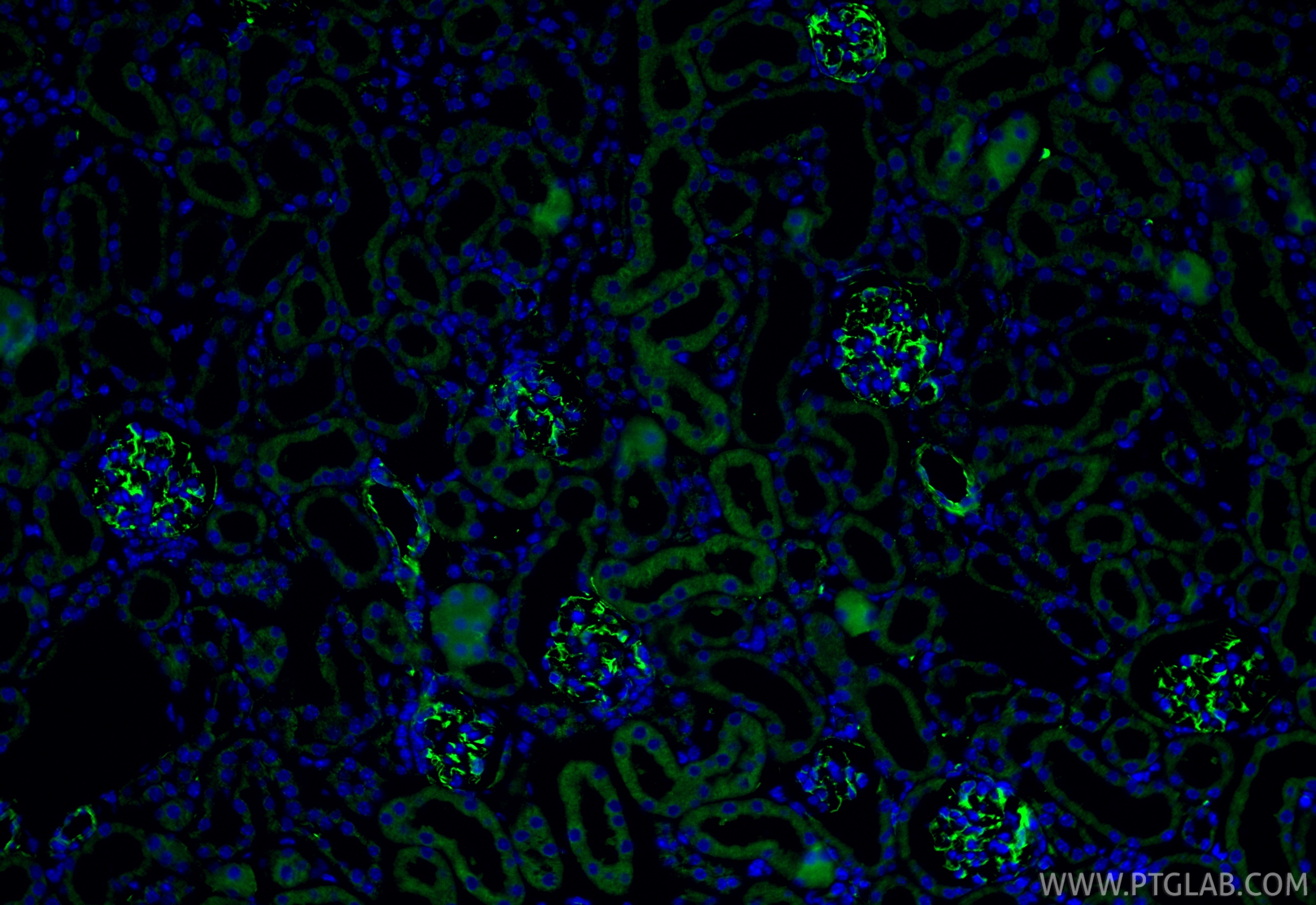 Immunofluorescence (IF) / fluorescent staining of mouse kidney tissue using Vimentin Polyclonal antibody (22031-1-AP)