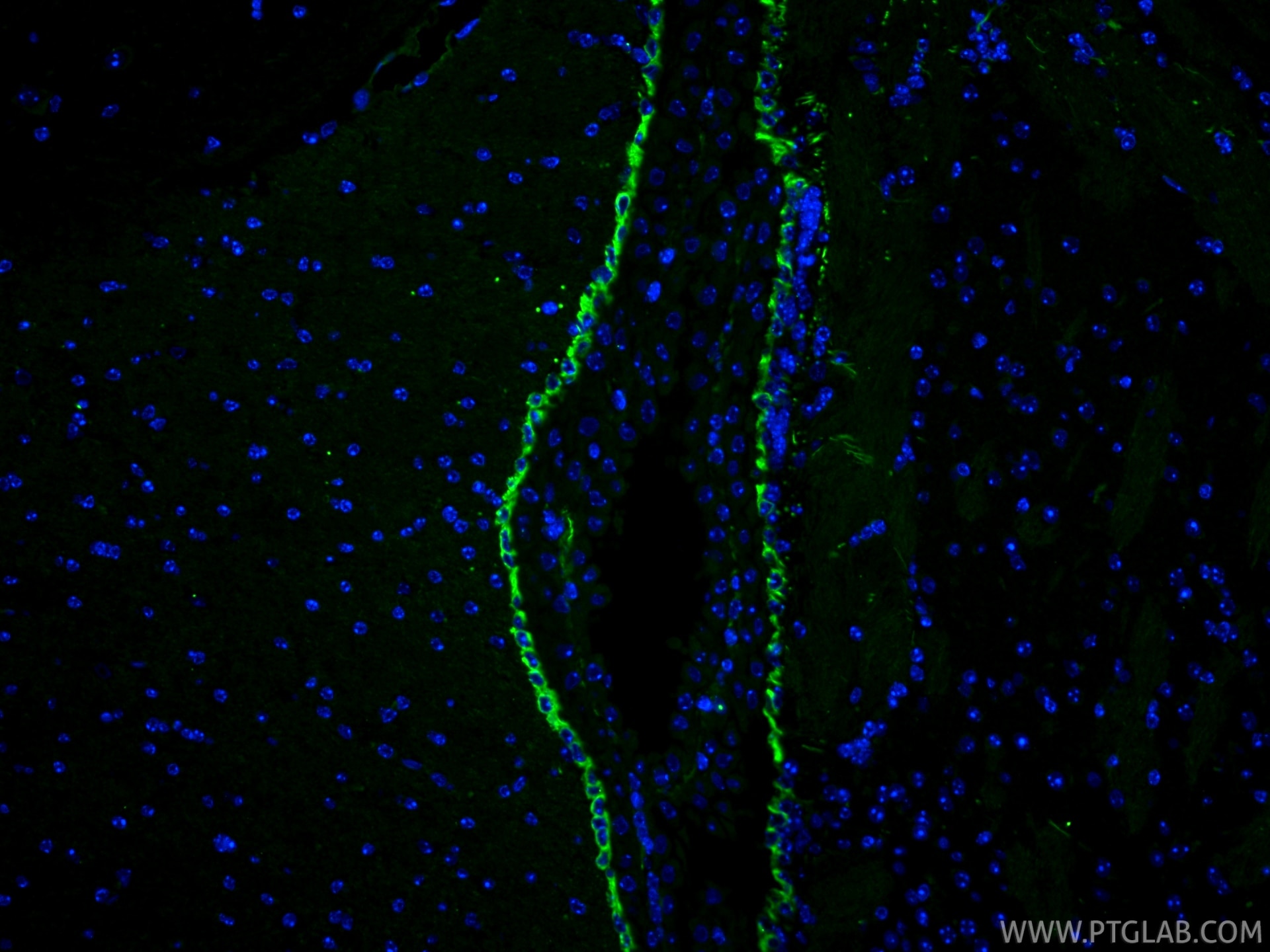 IF Staining of mouse brain using 22031-1-AP Immunofluorescence (IF) / fluorescent staining of mouse brain tissue using Vimentin Polyclonal antibody (22031-1-AP)