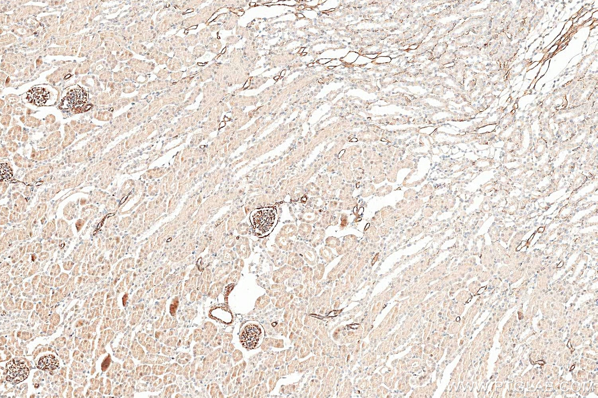 Immunohistochemistry (IHC) staining of mouse kidney tissue using Vimentin Polyclonal antibody (22031-1-AP)