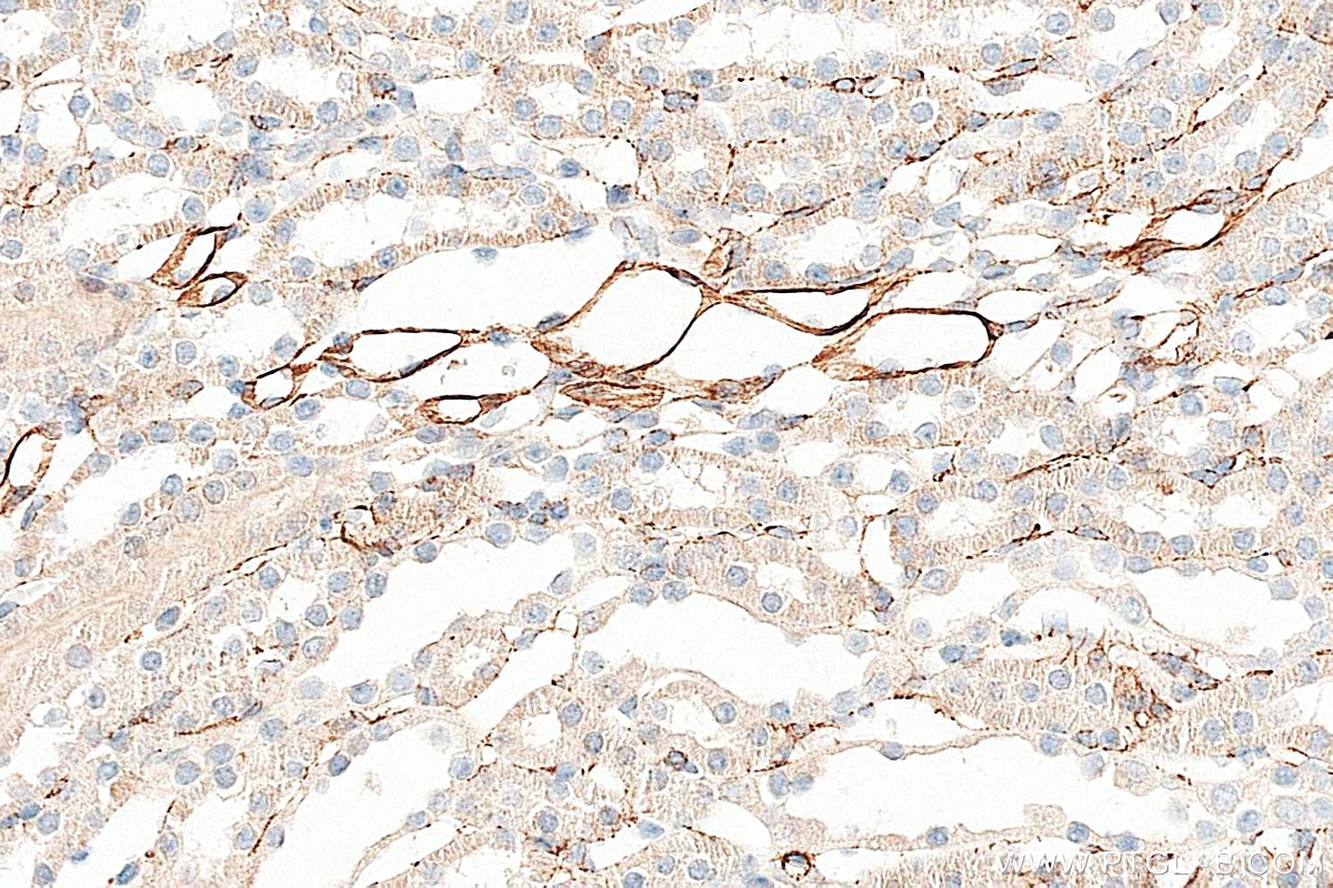 Immunohistochemistry (IHC) staining of mouse kidney tissue using Vimentin Polyclonal antibody (22031-1-AP)