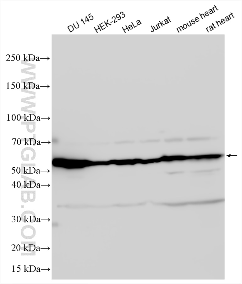 Various lysates were subjected to SDS PAGE followed by western blot with 22031-1-AP (Vimentin antibody) at dilution of 1:4000 incubated at room temperature for 1.5 hours. Western Blot (WB) analysis of various lysates using Vimentin Polyclonal antibody (22031-1-AP)