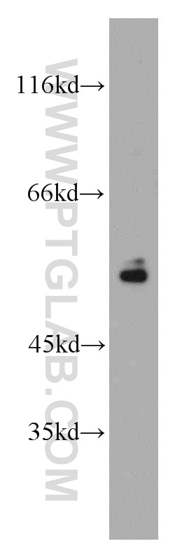 Western Blot (WB) analysis of HeLa cells using Vimentin Polyclonal antibody (22031-1-AP)