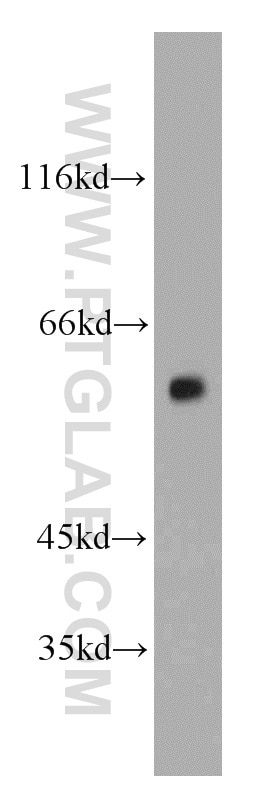 Western Blot (WB) analysis of mouse heart tissue using Vimentin Polyclonal antibody (22031-1-AP)