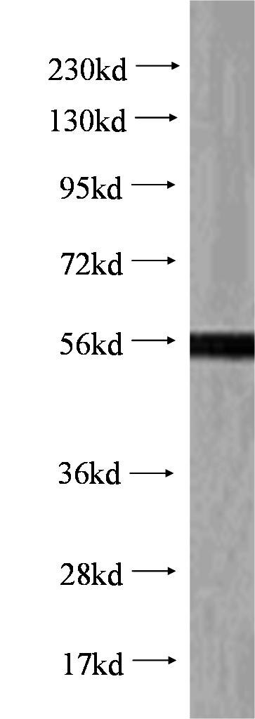 Western Blot (WB) analysis of A549 cells using VIM Monoclonal antibody (65039-1-Ig)