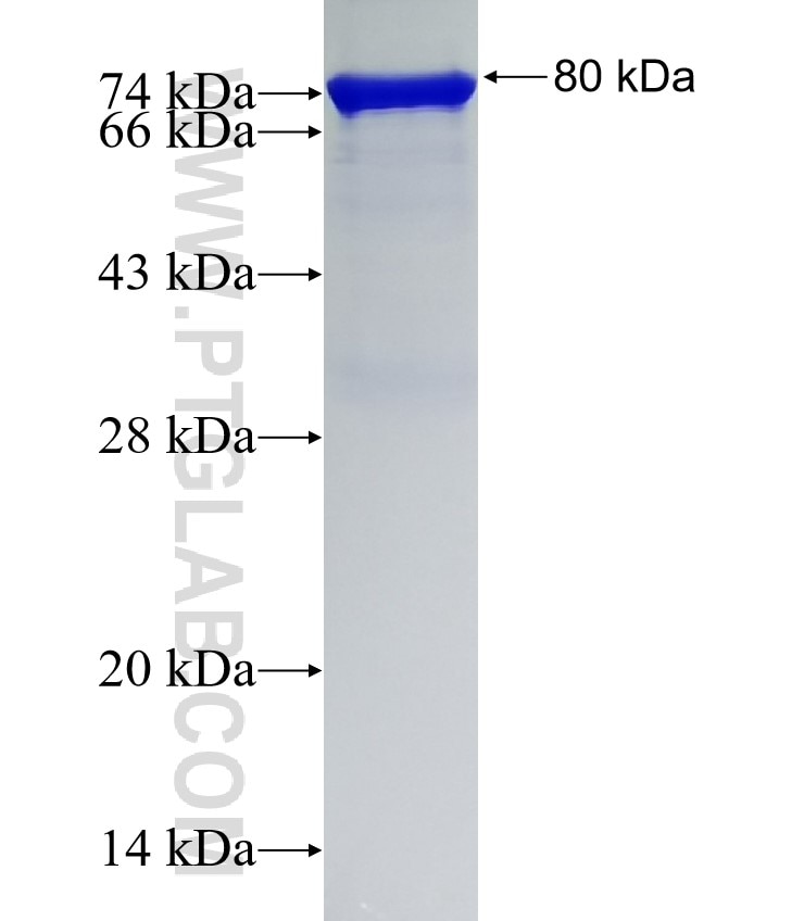 Vimentin fusion protein Ag0489 SDS-PAGE