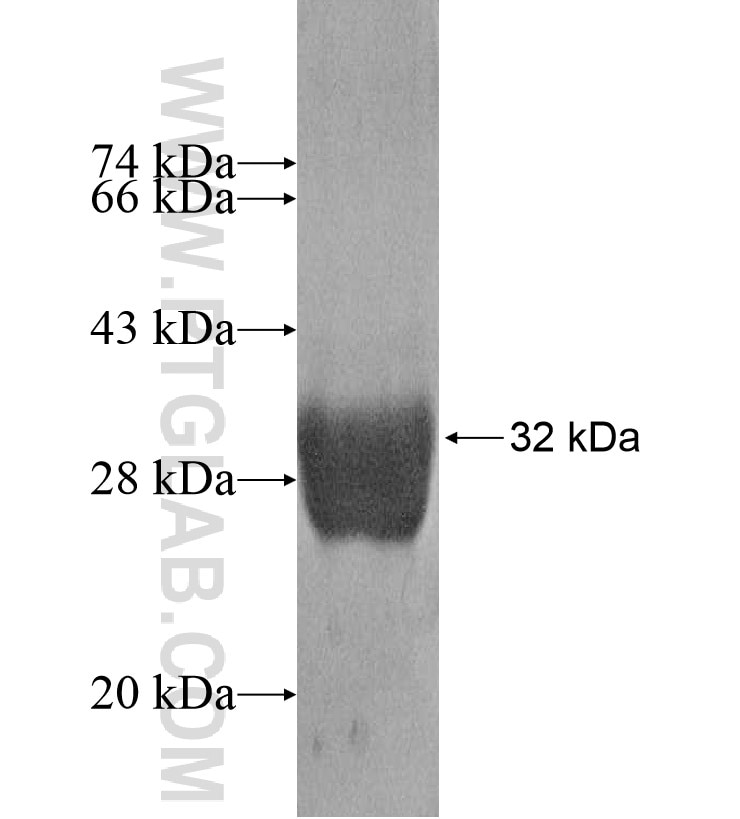 Vimentin fusion protein Ag16898 SDS-PAGE