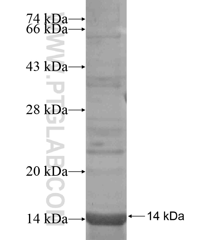 Vimentin fusion protein Ag17441 SDS-PAGE