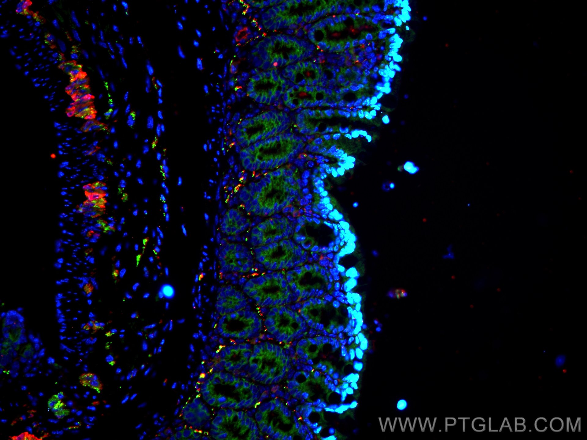 Immunofluorescence (IF) / fluorescent staining of mouse colon tissue using VIP Polyclonal antibody (16233-1-AP)