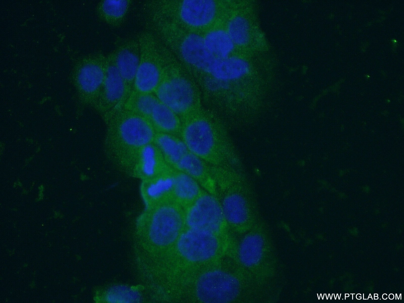 Immunofluorescence (IF) / fluorescent staining of COLO 320 cells using VIP Polyclonal antibody (16233-1-AP)