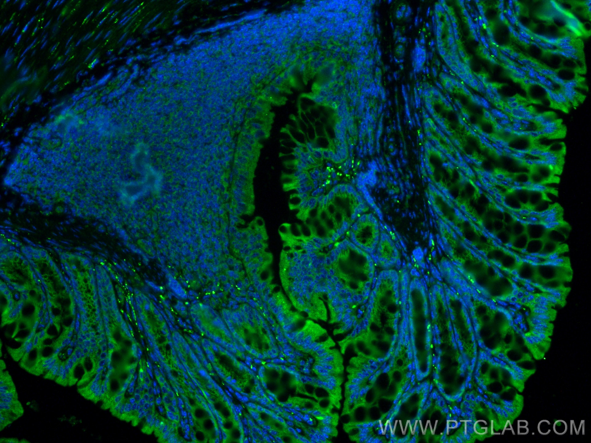 Immunofluorescence (IF) / fluorescent staining of mouse colon tissue using VIP Polyclonal antibody (16233-1-AP)