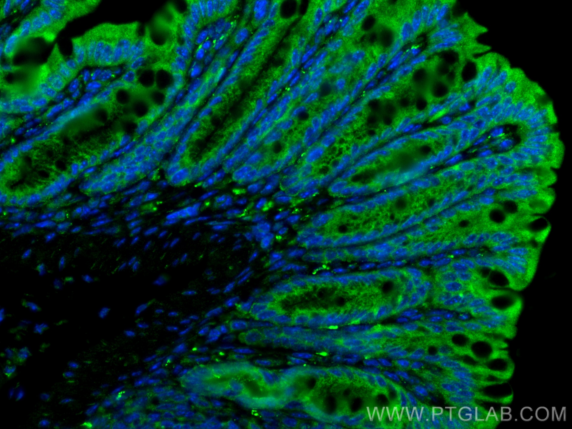 Immunofluorescence (IF) / fluorescent staining of mouse colon tissue using VIP Polyclonal antibody (16233-1-AP)