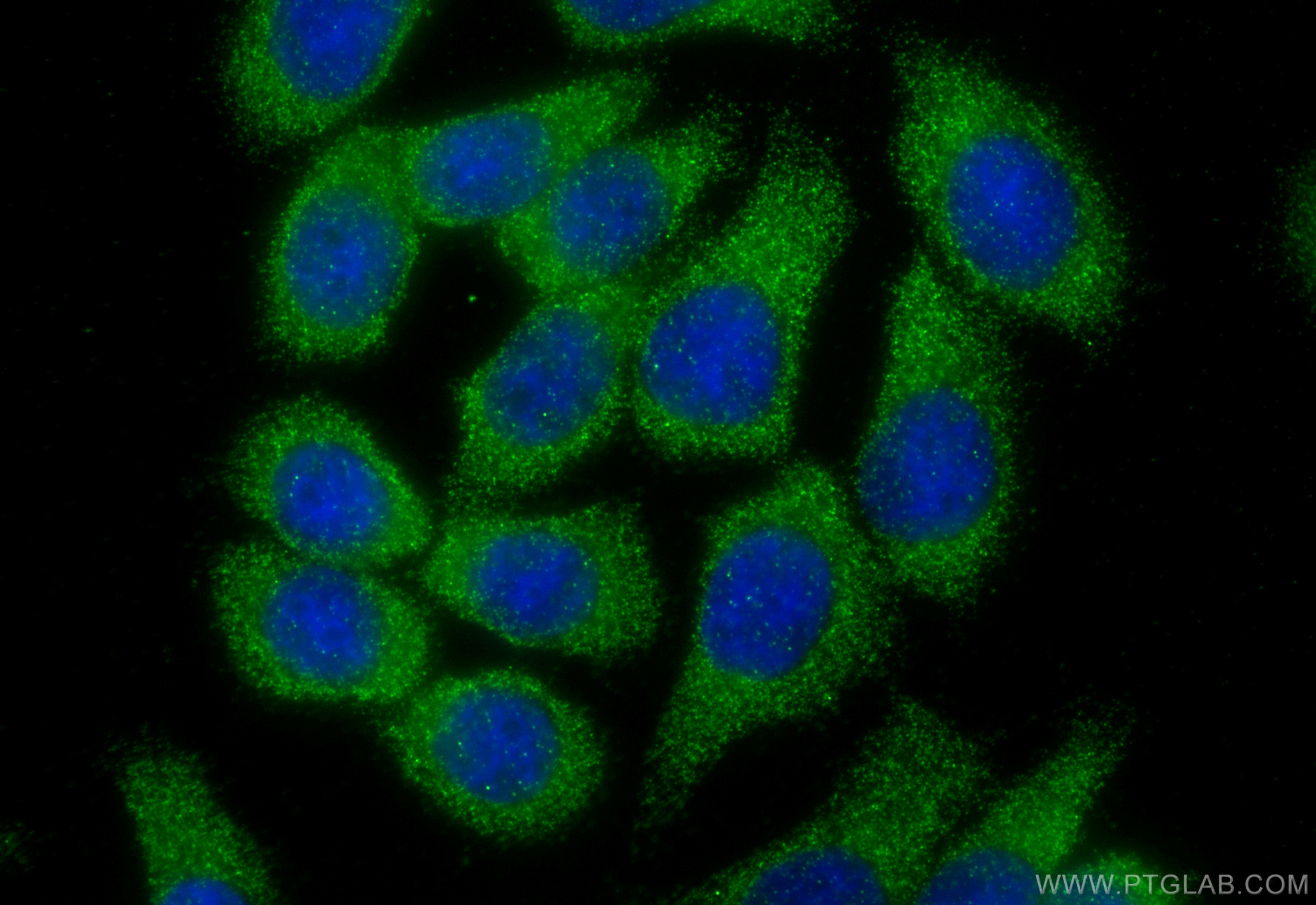 Immunofluorescence (IF) / fluorescent staining of HT-29 cells using VIP Polyclonal antibody (16233-1-AP)