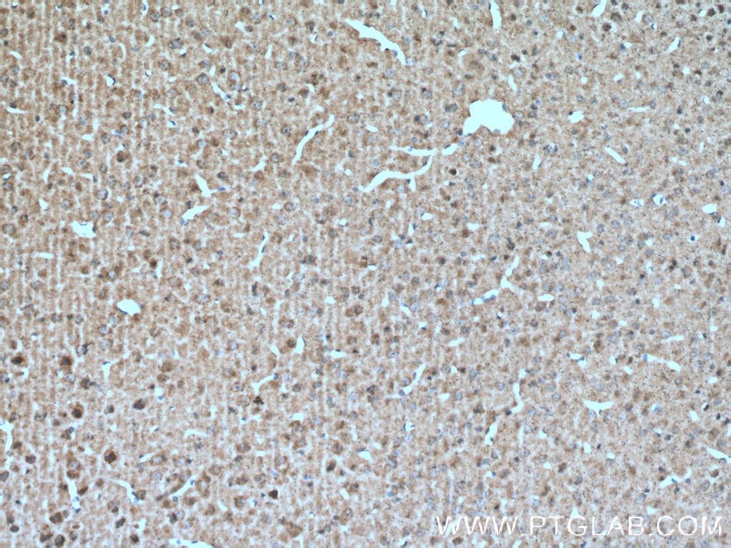 Immunohistochemistry (IHC) staining of mouse brain tissue using VIP Polyclonal antibody (16233-1-AP)