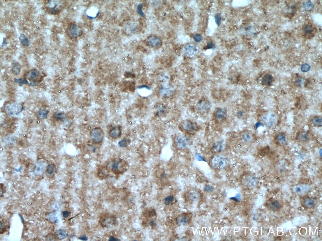 Immunohistochemistry (IHC) staining of mouse brain tissue using VIP Polyclonal antibody (16233-1-AP)