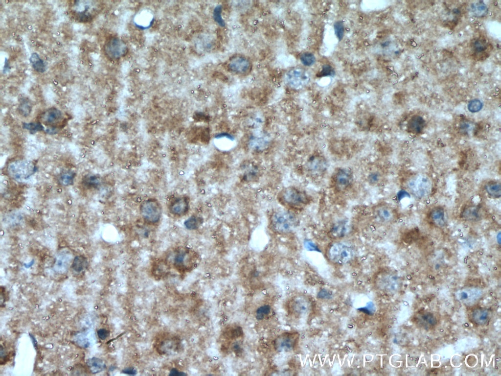 IHC staining of mouse brain using 16233-1-AP